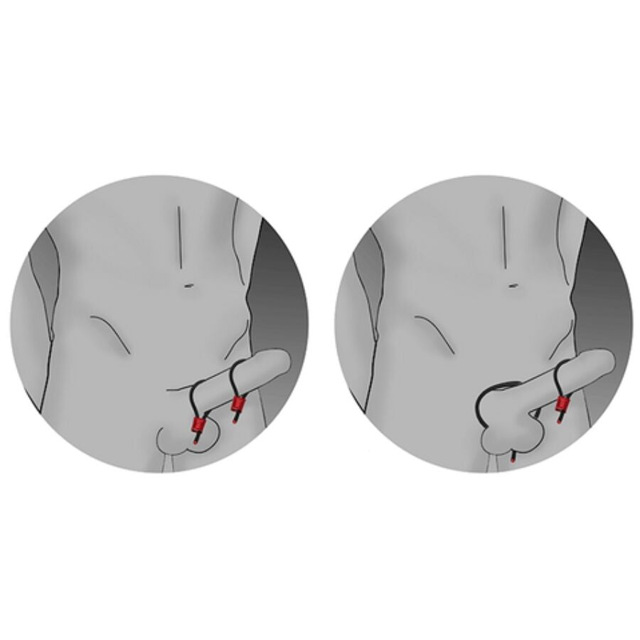 ELECTRASTIM - PRESTIGE ELECTRA LOOPS ADJUSTABLE RED PENIS RINGS