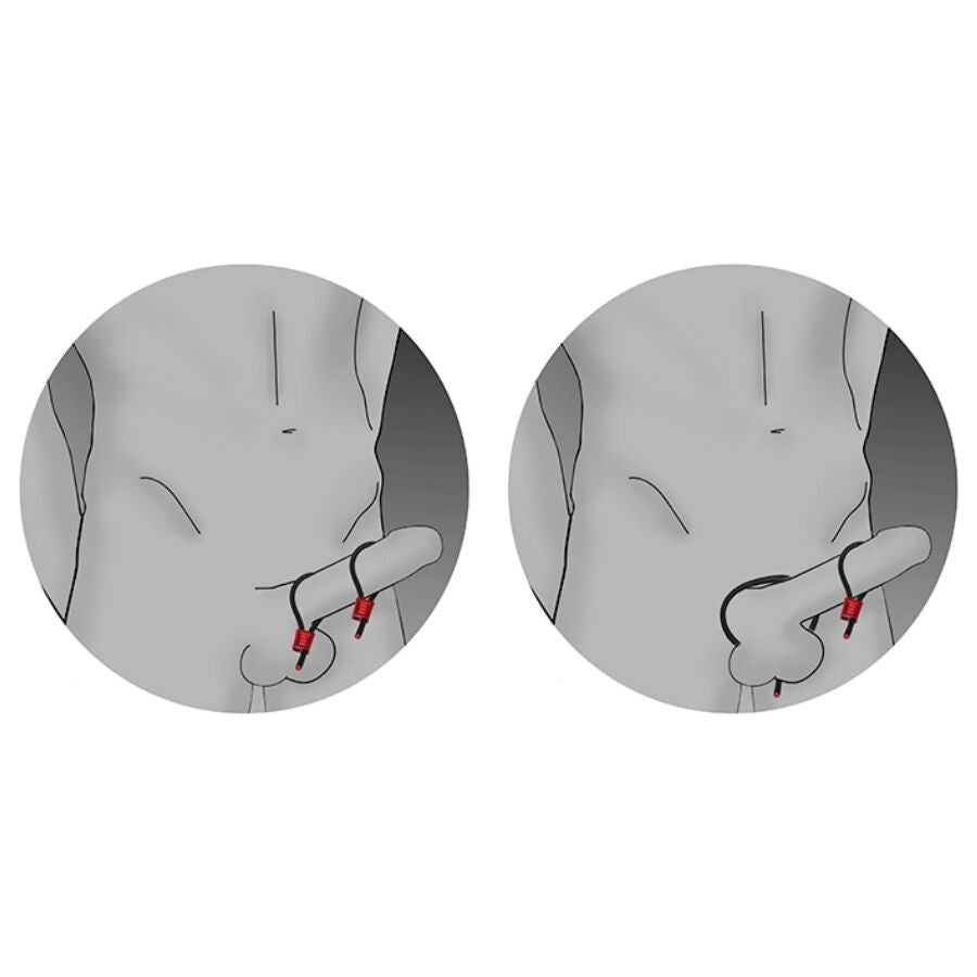 ELECTRASTIM - PRESTIGE ELECTRA LOOPS ADJUSTABLE BLACK PENIS RINGS